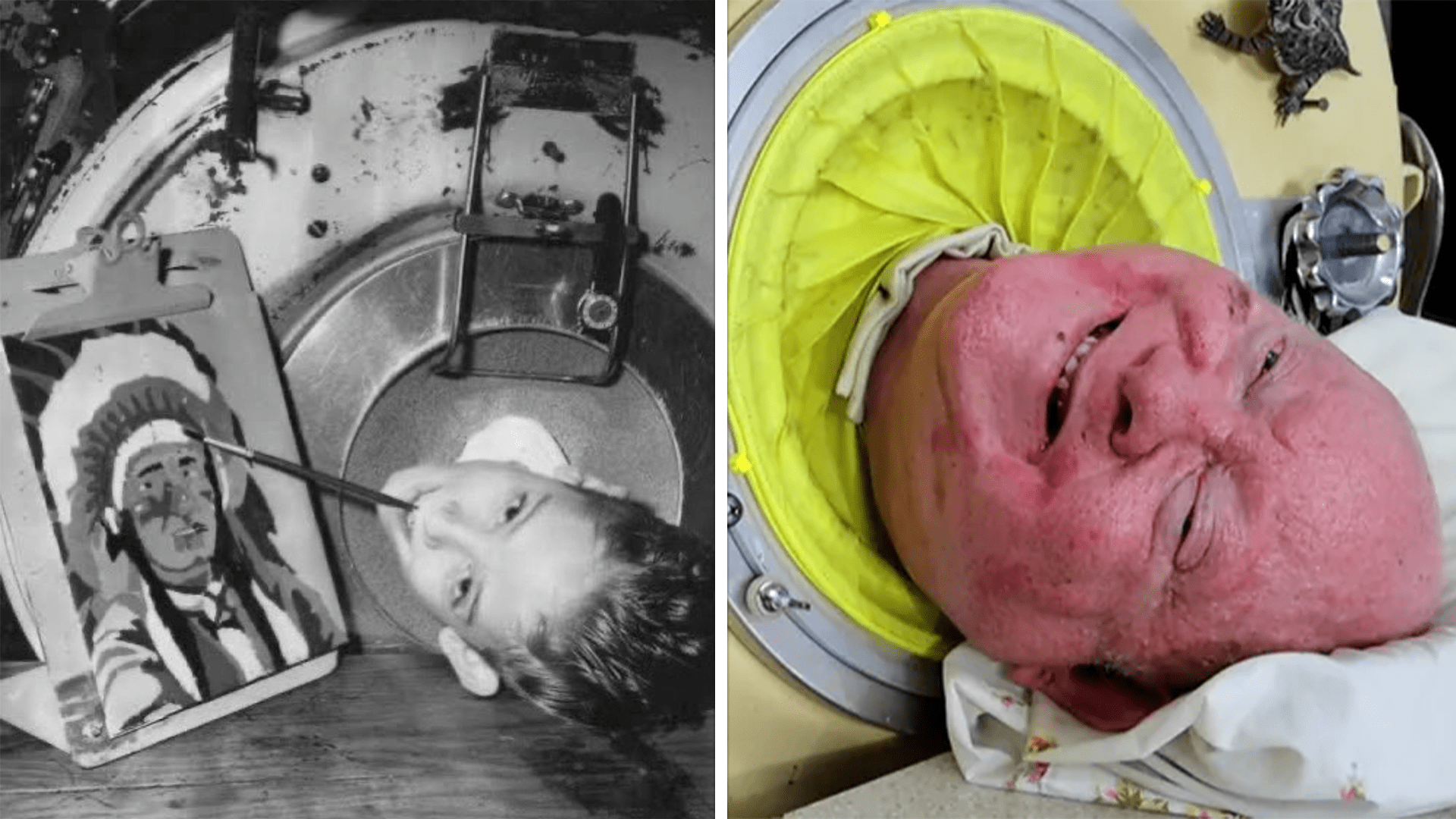 Paul Alexander, The Man Who Lived In An Iron Lung For Over 70 Years Has ...